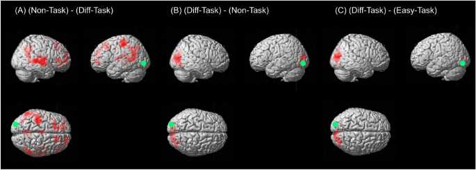 Effects of Blurred Visual Stimuli on Brain Function