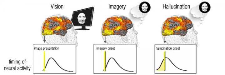Unraveling the Neural Mechanisms of Blurred Vision: Evidence from Brain Activity Patterns